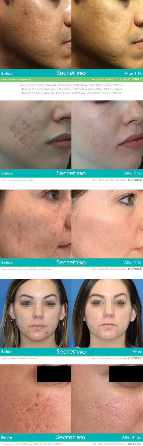 Secret Pro_B&A_Rishi
